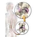 Tubo flexível CAUTEX/FACET 995011